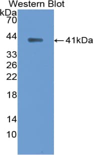 ANK1 / Ankyrin Antibody (aa32-369, Biotin)