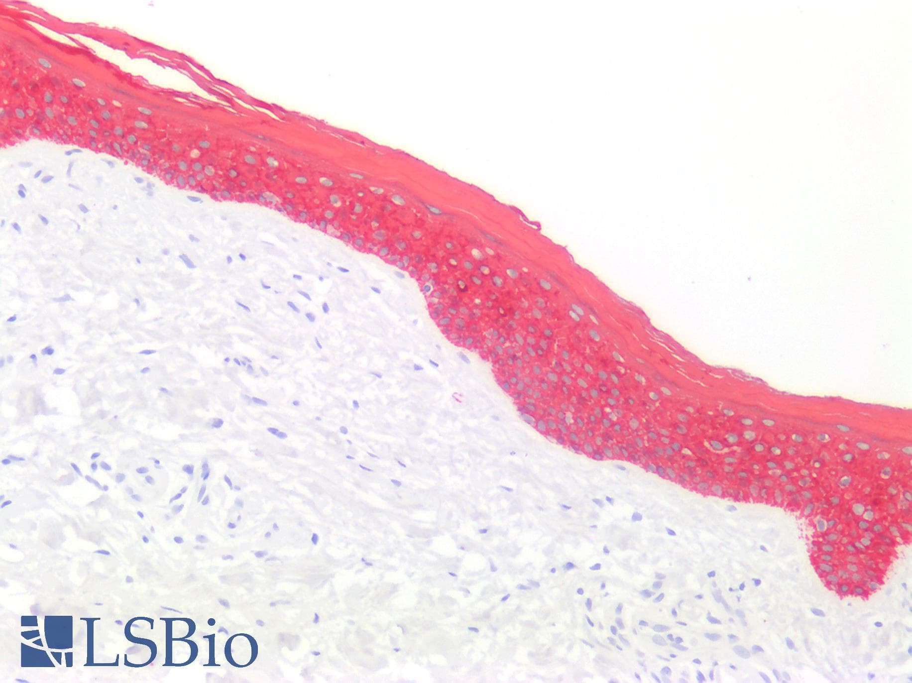 PathPlus™ Basic Cytokeratin AE3 Antibody (clone AE3)
