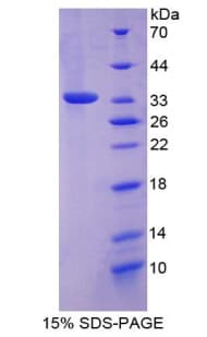 Mouse FRA-1 / FOSL1 Protein (Recombinant His-T7)