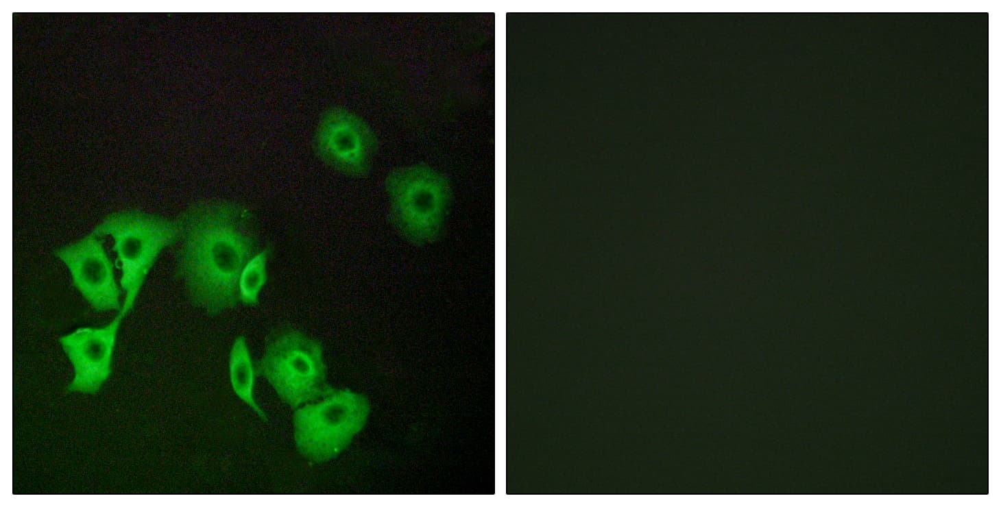FOXE2 / FOXE1 Antibody (aa51-100)