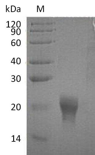 Human IL5 Protein (Recombinant 6His, C-terminus)