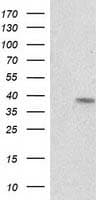 RDH14 Antibody (clone OTI6C3, Carrier-free)