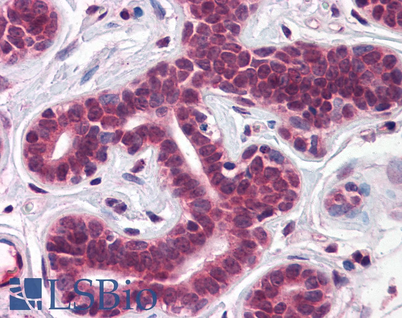 Polyclonal Rabbit anti-Human TBX18 Antibody (aa511-560, IHC, WB)