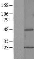 PIPOX / Sarcosine Oxidase Protein (Over-Expression Lysate Myc-DDK (Flag))