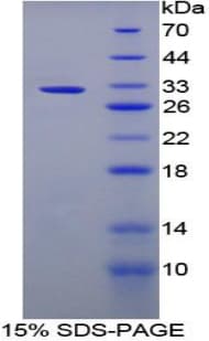 Rabbit LBP Protein (Recombinant His-T7)