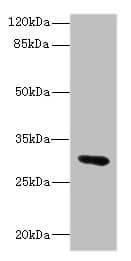 Polyclonal Rabbit anti-Human UPK3A / UPK3 / Uroplakin III Antibody (aa19-207, WB)