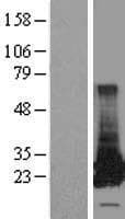 GSTT2 Protein (Over-Expression Lysate Myc-DDK (Flag))