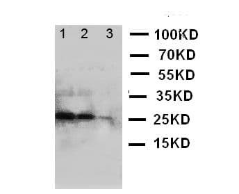 BAFF / TNFSF13B Antibody (aa265-285)