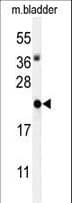 Polyclonal Rabbit anti-Human ID4 Antibody (aa1-30, IHC, WB)
