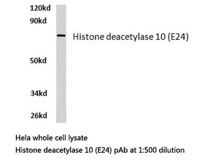 Polyclonal Rabbit anti-Human HDAC10 Antibody (Glu24, IHC, WB)