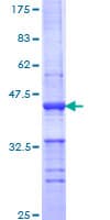 Human PLD1 / Phospholipase D1 Protein (Recombinant GST, N-terminus)