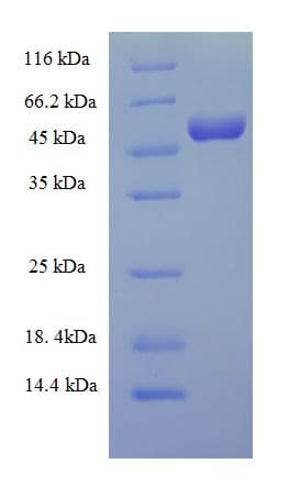 Mouse Complement C3 Protein (Recombinant His-SUMO)