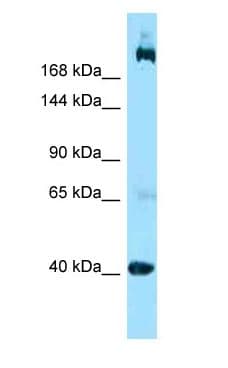 Polyclonal Rabbit anti-Human SHANK2 / SHANK Antibody (aa1446-1495, WB)
