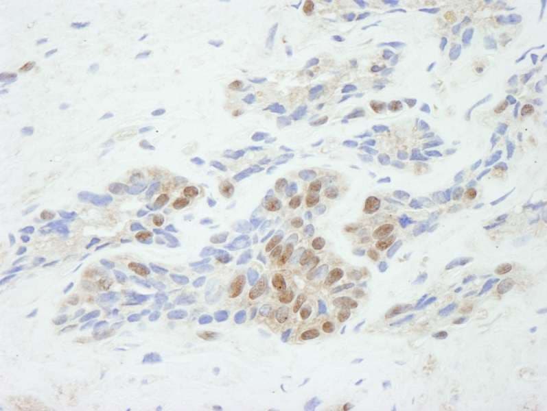 TP53BP2 / ASPP2 Antibody (aa825-875)