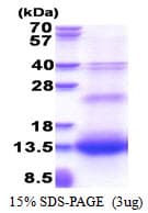 Human RETN / Resistin Protein (Recombinant His)