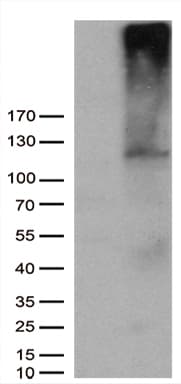 Monoclonal Mouse anti-Human AFAP1 / AFAP Antibody (clone OTI1E9, WB)