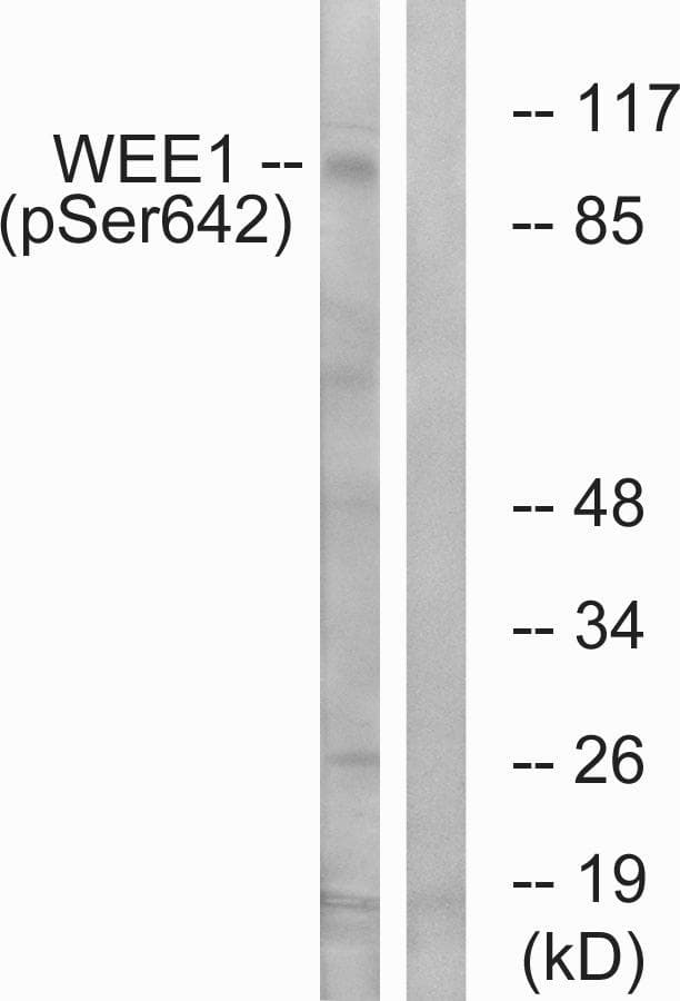 WEE1 Antibody (phospho-Ser642)