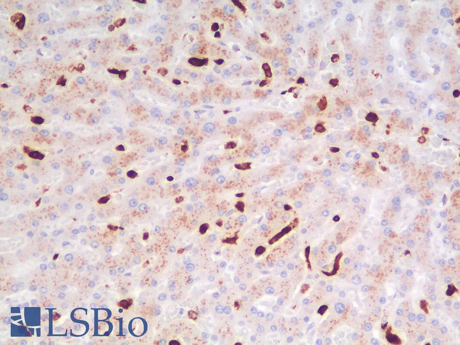 PathPlus™ Recombinant Monoclonal Rabbit anti-Human CD68 Antibody (clone C68/2908R, IHC, WB)