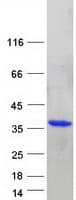 Human DENR / Density Regulated Protein (Recombinant Myc-DDK (Flag))
