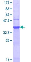 Human CHRNB2 Protein (Recombinant GST, N-terminus)