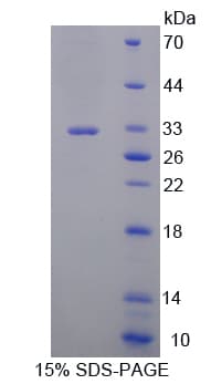 Mouse GSR / Glutathione Reductase Protein (Recombinant His-T7)