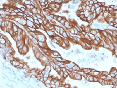 Recombinant Monoclonal Rabbit anti-Human KRT18 / CK18 / Cytokeratin 18 Antibody (clone KRT18/2808R, Azide-free,Carrier-free, IHC, IF, WB)