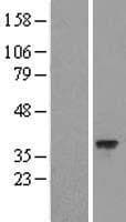 HARBI1 Protein (Over-Expression Lysate Myc-DDK (Flag))