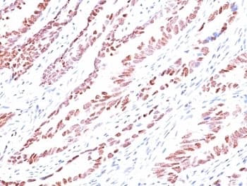 CDKN1C / p57 Kip2 Antibody (clone KP10, Ready-to-Use)