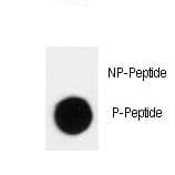 CDKN1B / p27 Kip1 Antibody (phospho-Thr198)