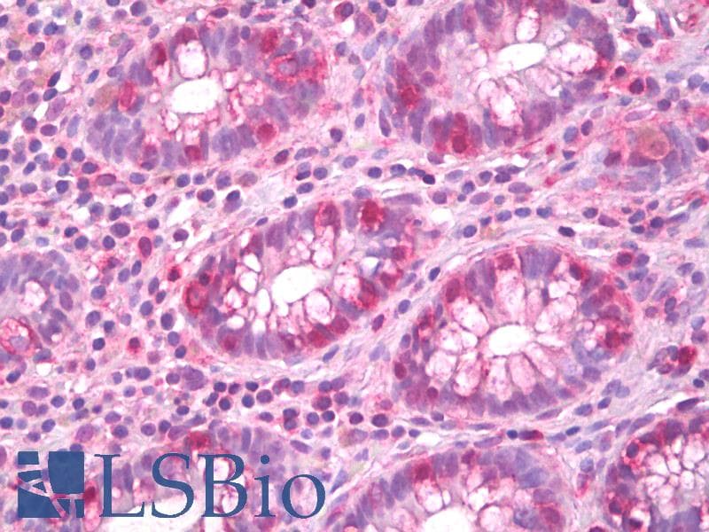 IHC-plus™ PRKAB1 / AMPK Beta 1 Antibody (aa147-196)
