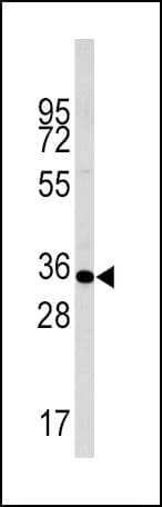 CASP6 / Caspase 6 Antibody (phospho-Ser257)