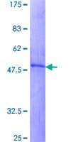 Human IGFBP1 Protein (Recombinant GST)
