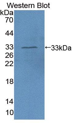 HAVCR1 / KIM-1 Antibody (aa21-240, Cy3)