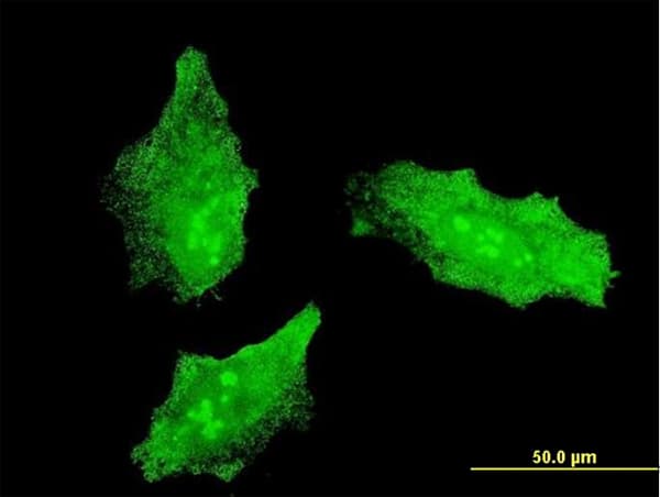 MKI67 / Ki67 Antibody (clone 7B8)