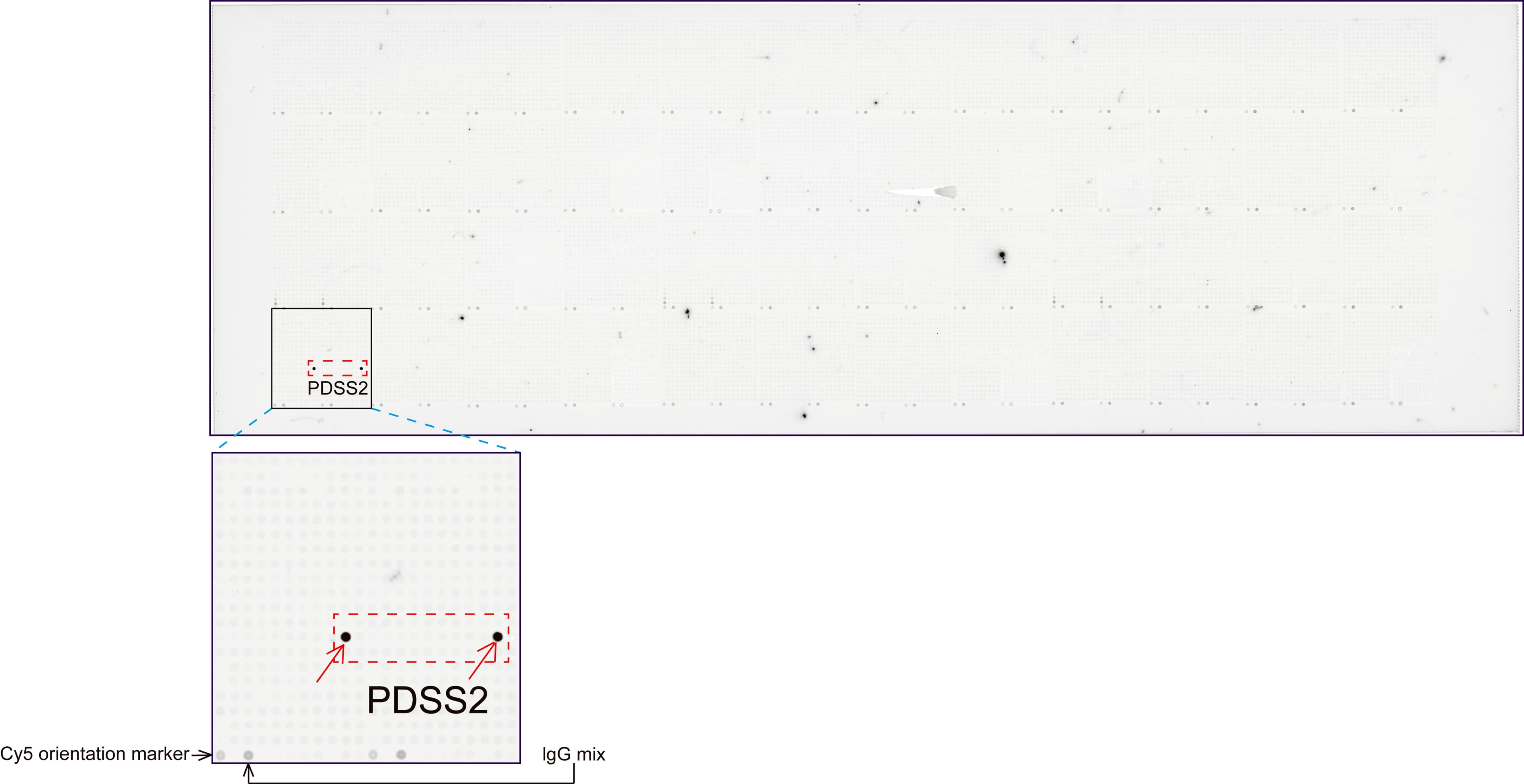 Monoclonal Mouse anti-Human PDSS2 / DLP1 Antibody (clone UMAB177, IHC, WB)