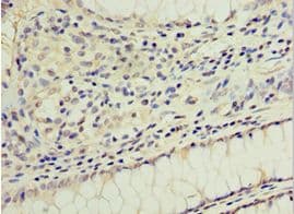 GS28 / GOSR1 / p28 Antibody (aa1-115)