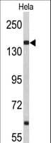Polyclonal Rabbit anti-Human NUP153 Antibody (aa58-86, WB)