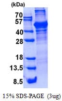 Human LCAT Protein (Recombinant His)