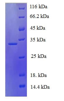 Human NGB / Neuroglobin Protein (Recombinant His-SUMO)