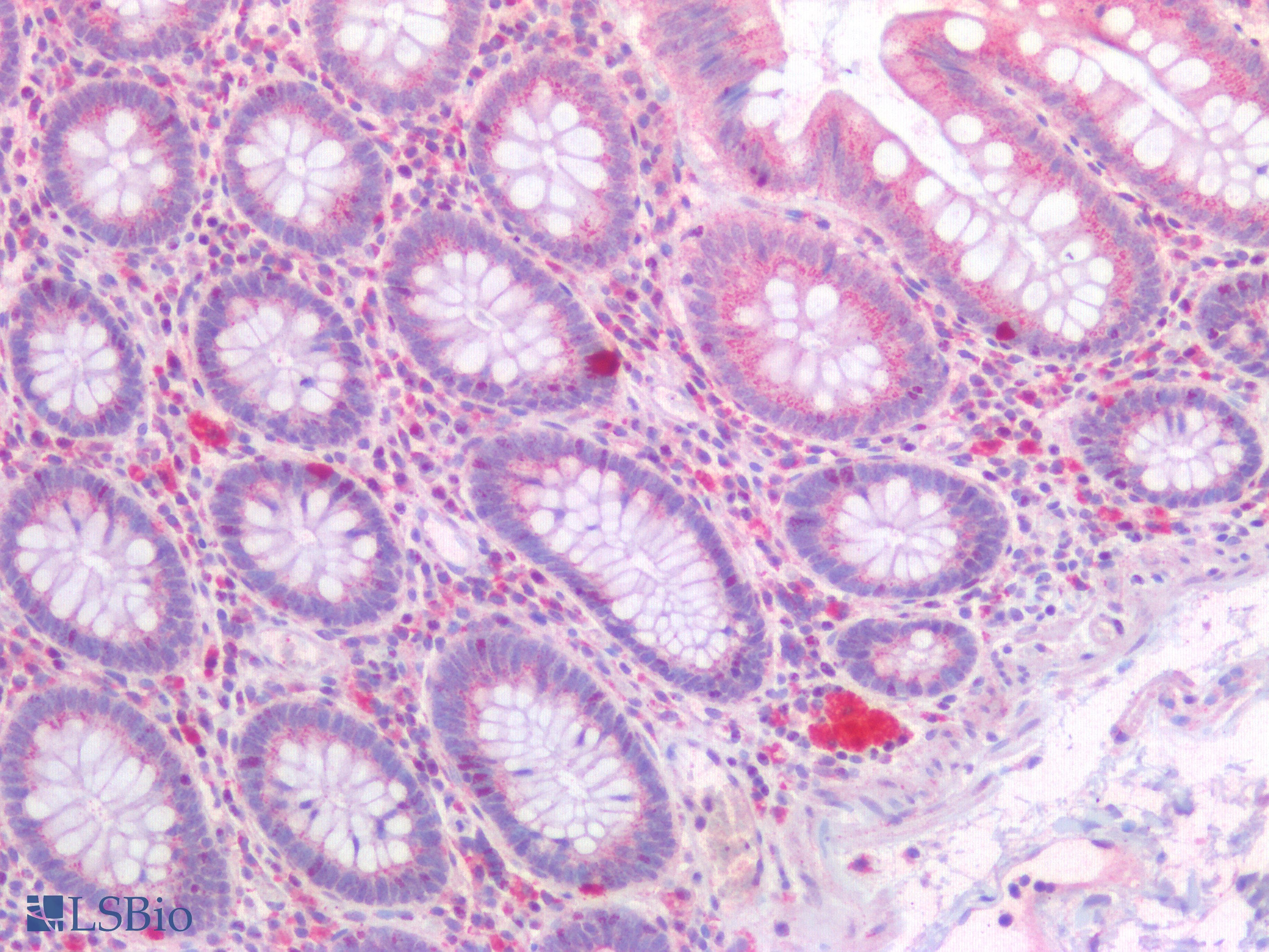 PathPlus™ PDGFRA / PDGFR Alpha Antibody