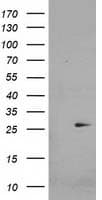 Monoclonal Mouse anti-Human CDKN3 / KAP Antibody (clone OTI1C7, IF, WB)