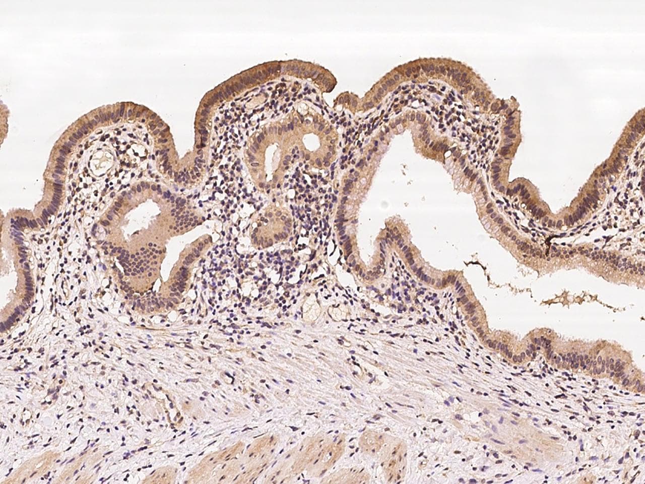 ERG1 / SQLE Antibody