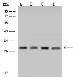 Polyclonal Rabbit anti-Human NSMCE1 Antibody (WB)