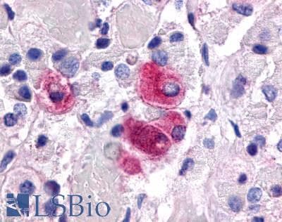 PathPlus™ NR5A1 / SF1 Antibody (Internal)