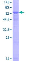 Human SMPD2 Protein (Recombinant GST)
