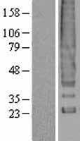 Human ACKR1 / DARC Protein (Over-Expression Lysate Myc-DDK (Flag))