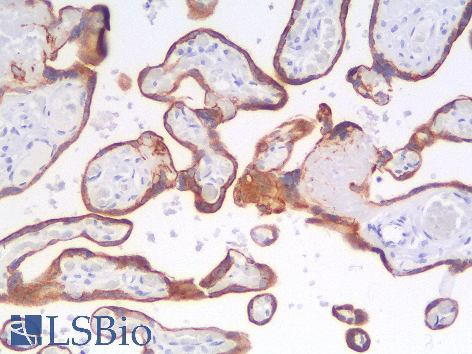 IHC-plus™ KRT8 / CK8 / Cytokeratin 8 Antibody (clone rB22.1)