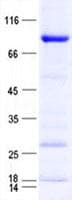 Human RARA / RAR Alpha Protein (Recombinant GST, N-terminus + His, C-terminus)