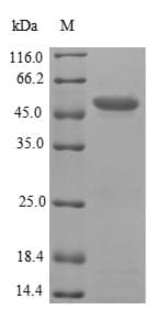 Human PNMA2 / MA2 Protein (Recombinant 6His-SUMO, N-terminus)