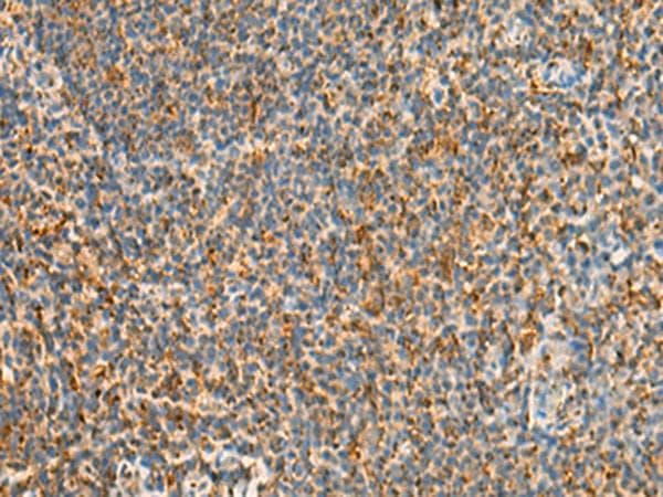 STK32C / PKE Antibody